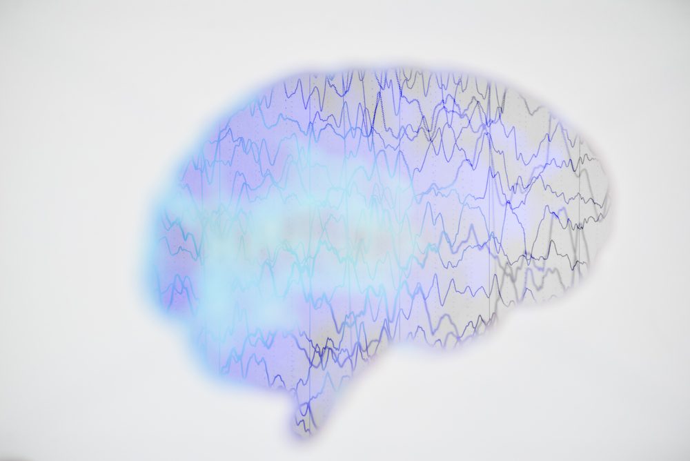 brain,wave,on,electroencephalogram,eeg,for,epilepsy