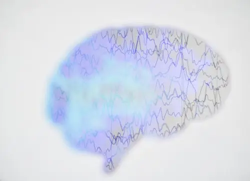 brain,wave,on,electroencephalogram,eeg,for,epilepsy